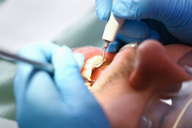 Best Emergency Treatment for Oral Infections in Auburndale, FL
