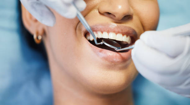 Best Emergency Dental Care for Sports Injuries in Auburndale, FL
